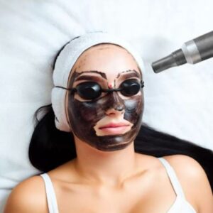 FACIAL HOLYWOOD PEEL - Image 1